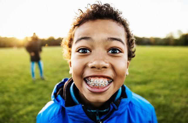 A Parent's Guide to Dental Braces for Kids: When and Where to Start – 4aKid